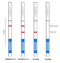 Human IgG Fc Lateral Flow Dipstick Assay Test Interpretation