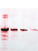 Gold Protein Detection Kit for Membranes
