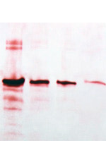 Gold Protein Detection Kit for Membranes